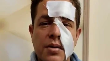 طالب إعدادي يصيب معلمه بجروح خطيرة باستخدام آلة حادة في حادثة مروعة